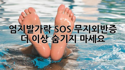 엄지발가락 SOS🚨 무지외반증, 더 이상 숨기지 마세요! 👣